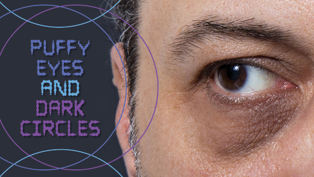 Eye Basics 101 – What Causes Puffy Eyes?